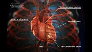 Angioplastia Coronária  Ultrassom  Hospital Cardiológico Costantini [upl. by Nylaehs157]