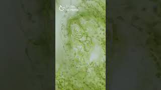 Anabaena azollae en cavidad foliar de Azolla sp Corte a mano [upl. by Nitsu]