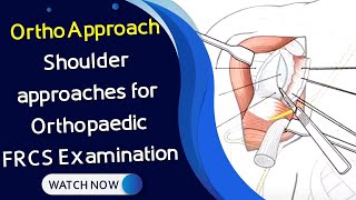 OrthoApproach  Shoulder approaches for Orthopaedic FRCS Examination [upl. by Aleahcim]