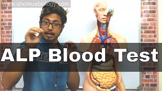 ALP blood Test in Hindi alkaline phosphatase test [upl. by Stephen]