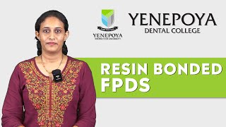 Resin Bonded Fixed Partial Dentures  Prosthodontics  Yenepoya Dental College [upl. by Ahsino]