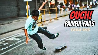 Broken Bones amp PAINFUL FAILS  Fails Compilation [upl. by Aninahs]