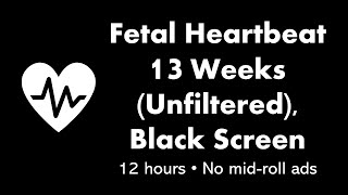 Fetal Heartbeat  13 Weeks Unfiltered 💓⬛ • 12 hours • No midroll ads [upl. by Erica]