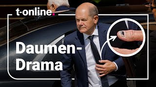 Olaf Scholz Das steckt hinter dem blauen KanzlerDaumen [upl. by Malkin]