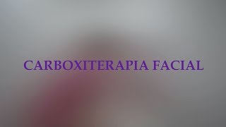 Carboxiterapia facial y corporal [upl. by Noirda]