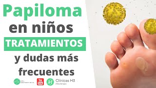 Papiloma en los pies de los niños y su tratamiento en Clínicas H3 [upl. by Julian]