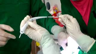 Percutaneous Dilational Tracheostomy PDT TRAKEOSTOMI [upl. by Suzetta]