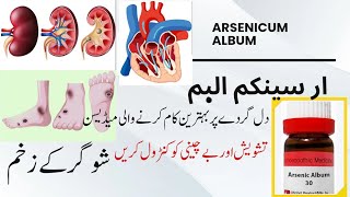 Arsenicum Album 30 200  Arsenicum uses and benefits  Rizwan Homoeopathic clinic [upl. by Hwang164]