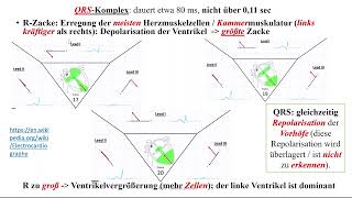 Herz 10 EKG 3  QRS Komplex T Welle und U Welle [upl. by Aliam51]