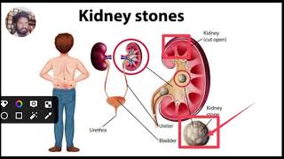 Medical Topic Videos Disease Treatment Hindi [upl. by Oconnor]