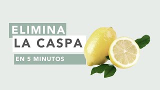 Elimina la caspa en 5 minutos [upl. by Initsed]