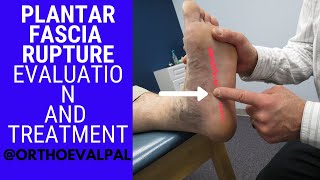 Plantar Fascia Rupture Evaluation with Paul Marquis PT [upl. by Trevethick]