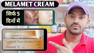 Melamet cream use dose benefits and side effects full review in hindi [upl. by Kadner]