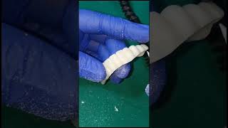 Shaping interdental papilla and gums for g cam bridge before Bredent gum layering [upl. by Alpers]