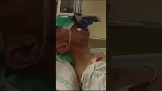 Medical Intubation Fixed Flexed Neck is a non issue when using the VS with the paraglossal technique [upl. by Eilime970]