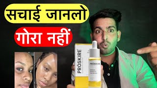 सचाई जानलो proskire serum Proskire vitamin c serum prodkire vitamin c serum side effects proskire [upl. by Tebasile]