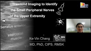 Ultrasound Imaging to Identify the Small Peripheral Nerves of the Upper Extremity [upl. by Amikan]