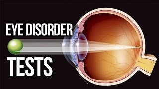 EYE DISORDER  Myopic Hyperopia Astigmatism TEST [upl. by Donia]