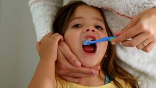 Bleeding Gums  What Do They Mean In Children [upl. by Sandi]