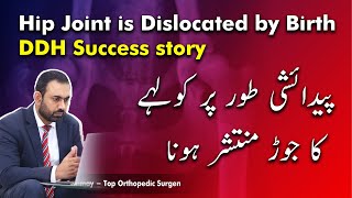 80 Hip Joint is Dislocated by Birth  DDH Success story  Dr Kashif Ramay  2020 [upl. by Aner]