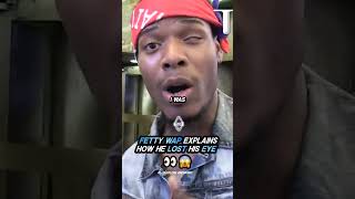 Fetty Wap EXPLAINS how he LOST His EYE 👀 [upl. by Nnylyaj]