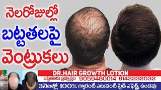 నెల రోజుల్లో బట్ట తలపై వెంట్రుకలు  Hair Fall Control In 30 Days  DR Hair Growth Lotion  TNN [upl. by Currier]