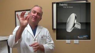 Toe Joint Replacement Surgery San Diego [upl. by Jaime]