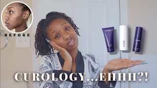 I Tried Curology For 30 Days amp This Happened Honest Review Hormonal Acne  Blemishes [upl. by Hermina308]