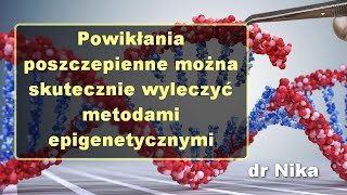 Powikłania poszczepienne można skutecznie wyleczyć metodami epigenetycznymi  dr Nika [upl. by Shel]