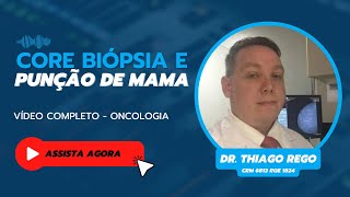 Core biopsia e punção de mama [upl. by Sewel946]