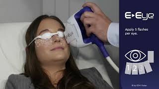 EEye trainings video teaser  US Ophthalmic [upl. by Arraet]