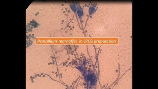 Penicillium marneffei [upl. by Aytak]