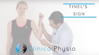 Tinels Test for Cubital Tunnel Syndrome  Clinical Physio [upl. by Adnawot]