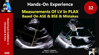 Measurements Of LV In PLAX Based On ASE amp BSE amp Mistakes Handson 32 [upl. by Modesta]