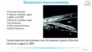 05 AUG 2023 Rohan Kapoor Peering into the eye A comprehensive look at ultrasound biomicroscopy U [upl. by Previdi]