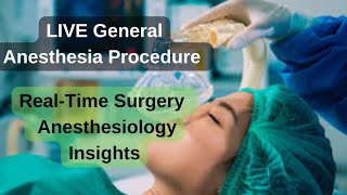 General Anesthesia  Live General Anesthesia Procedure  Anesthesiology Insights [upl. by Llekim329]