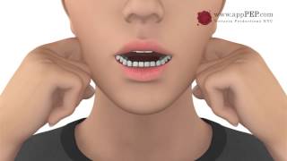 Part 1 » Retraining Articulators » Jaw Exercises [upl. by Teuton668]