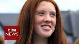 Redheads celebrate at convention in Ireland  BBC News [upl. by Anerev553]