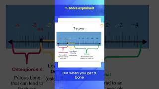 TScore Explained [upl. by Jamal]