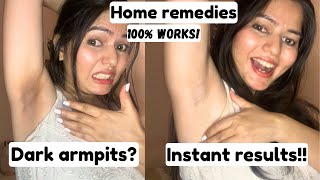 Home remedies to whiten your underarms in just one go  Bhawna Dashoni [upl. by Alleinad]