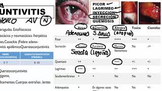 Oftalmología  1 RM19 2V DIA 1 OFTALMOLOGIA PARPADOS CONJUNTIVITIS [upl. by Assira]