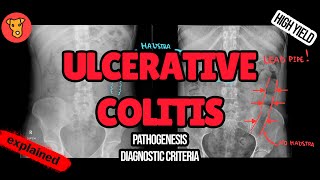 ULCERATIVE COLITIS Pathogenesis Diagnostic criteria Toxic megacolon Treatment [upl. by Pitts]