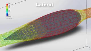 Flow Simulation  Drip profile analysis [upl. by Syman]