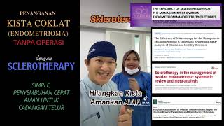 Terapi KISTA COKLAT endometrioma tanpa operasi Sclerotherapy Hilangkan kista amankan AMH [upl. by Enelaehs]