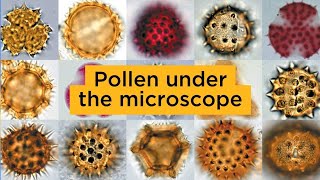 Pollen under the microscope [upl. by Altman496]