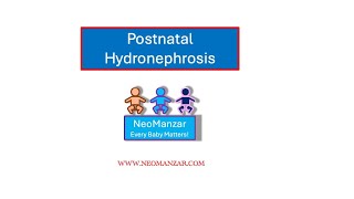 Postnatal Hydronephrosis Dx and Management [upl. by Grimonia866]