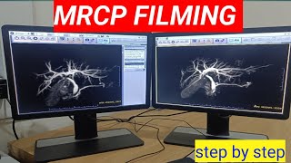 MRCP FILMING step by step MRCP FILMING ADW 47 WORKSTATION HOW TO MAKE MRCP FILMING [upl. by Rosner]