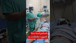 live treat patients on ventilator support ajeet Singh medical ki duniya short [upl. by Ziagos306]