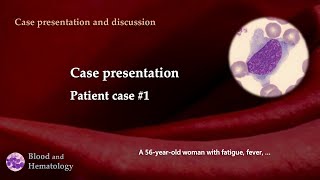 Patient case presentation case 1 [upl. by Cirilo234]