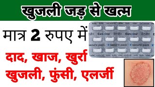 cetirizine tablet  cetirizine tablet uses in hindi  खुजली की गोली [upl. by Novj]